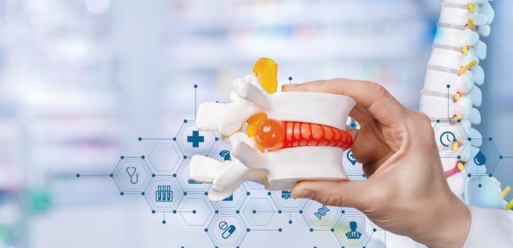 Hands holding a detailed spine model with an emphasis on the lumbar region, superimposed on a digital medical backdrop with health-related icons.
